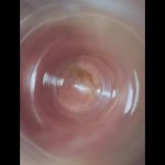 A deep look inside my ass