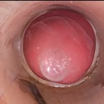 The camera in the deep pussy records a huge ejaculation of sperm into the condom Vidéos Porno