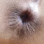 Hungry Ass Hole Wants to Eat Enjoy Close-up Anal 4k: Amateur Porn feat. Nastystuf Girl
