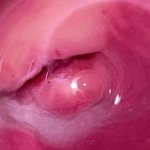 Camera inside vagina