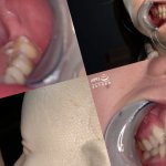 Popular actress Yukari Nonoka-chan39s teeth mouth and throat observation amp face licking nose blowjob play! ! !: ADOA: ToothMouth M: XCREAM