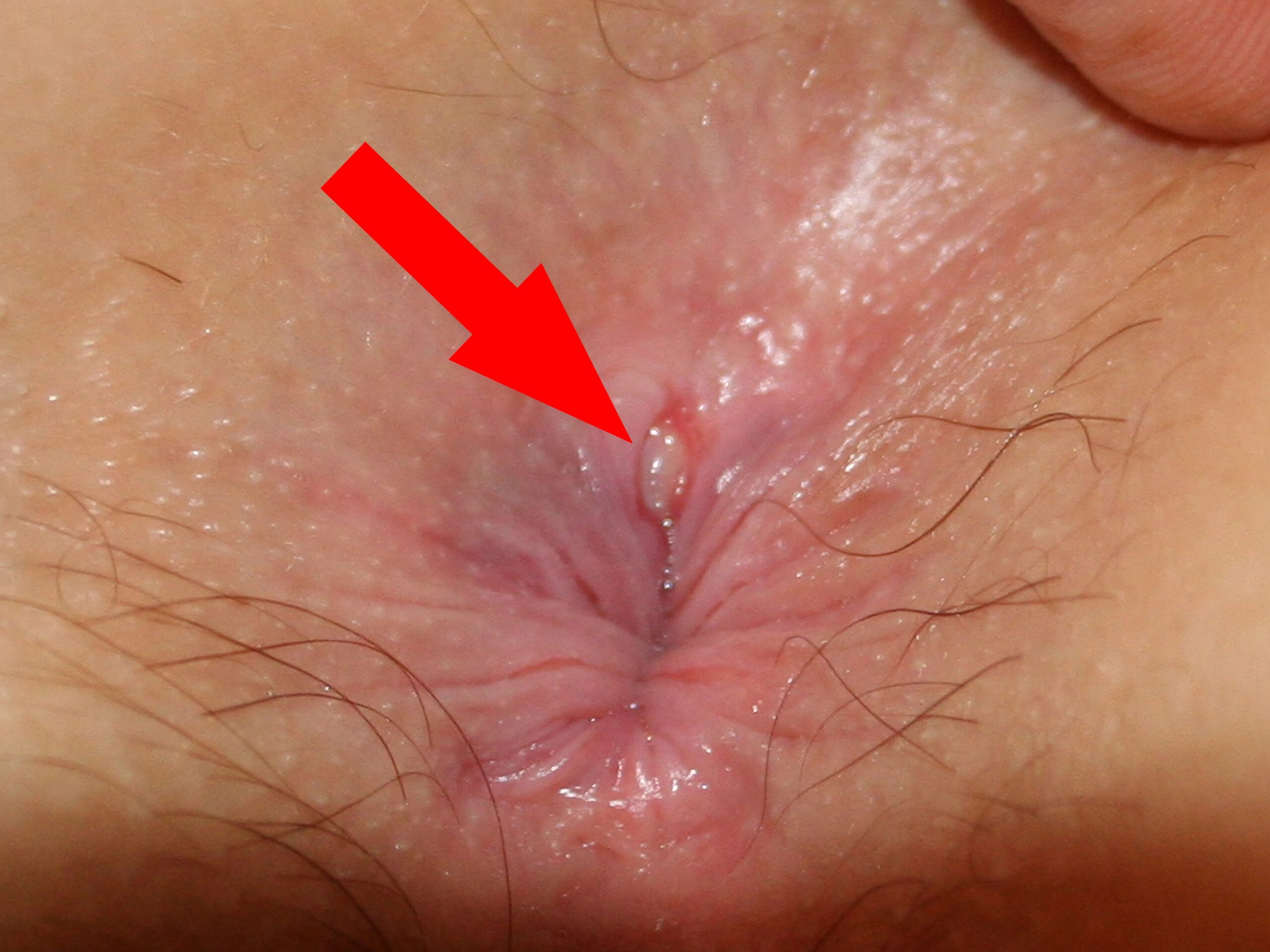Or anal (photos)